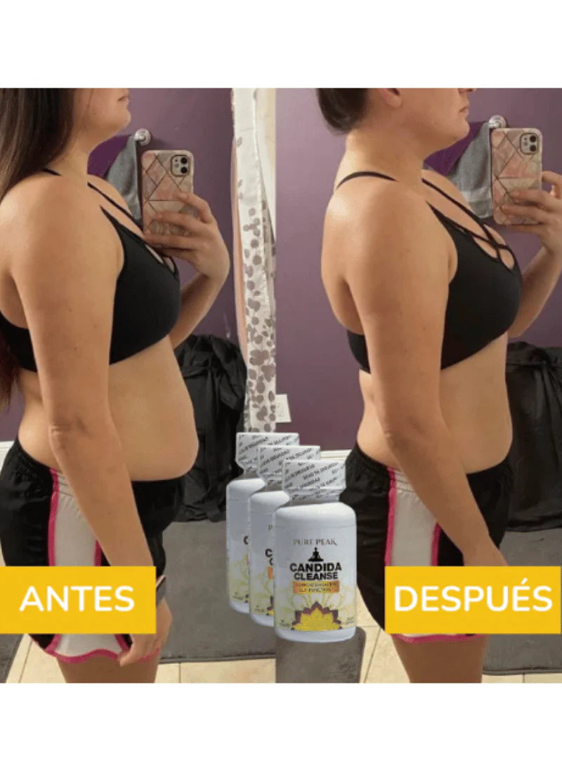 ¡50% OFF Solo Por Hoy!⚡ CANDIDA CLEANSE™